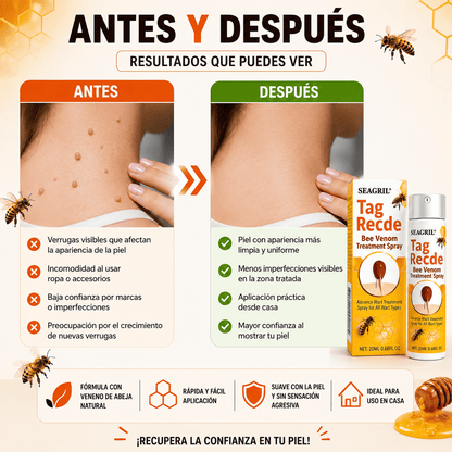 TAG RECEDE™ – Spray con veneno de abeja para verrugas, ayuda a secar y suavizar la piel desde la primera semana