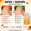 TAG RECEDE™ – Spray con veneno de abeja para verrugas, ayuda a secar y suavizar la piel desde la primera semana