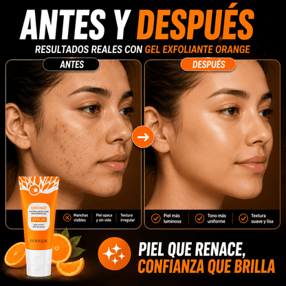 💖 EXFOLIANTE CORPORAL HIDRATANTE 50 GR – RENUEVA, HIDRATA Y MEJORA EL ASPECTO DE TU PIEL | ADIÓS MANCHAS OSCURAS Y RESEQUEDAD